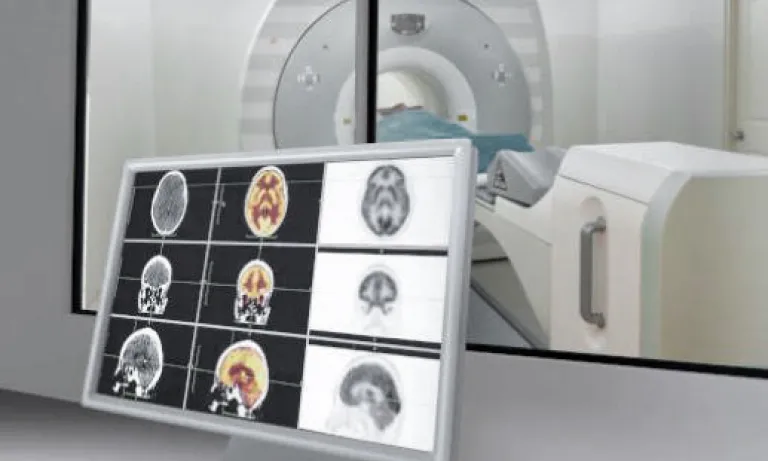 Magnetic Resonance Imaging
